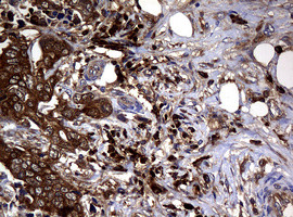 NME1 Antibody in Immunohistochemistry (Paraffin) (IHC (P))