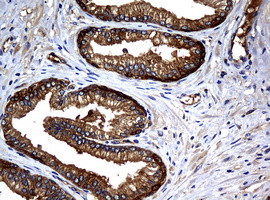 NME1 Antibody in Immunohistochemistry (Paraffin) (IHC (P))