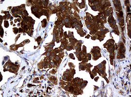 NME1 Antibody in Immunohistochemistry (Paraffin) (IHC (P))