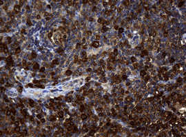 NME1 Antibody in Immunohistochemistry (Paraffin) (IHC (P))