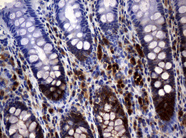 NME1 Antibody in Immunohistochemistry (Paraffin) (IHC (P))