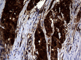 NME1 Antibody in Immunohistochemistry (Paraffin) (IHC (P))