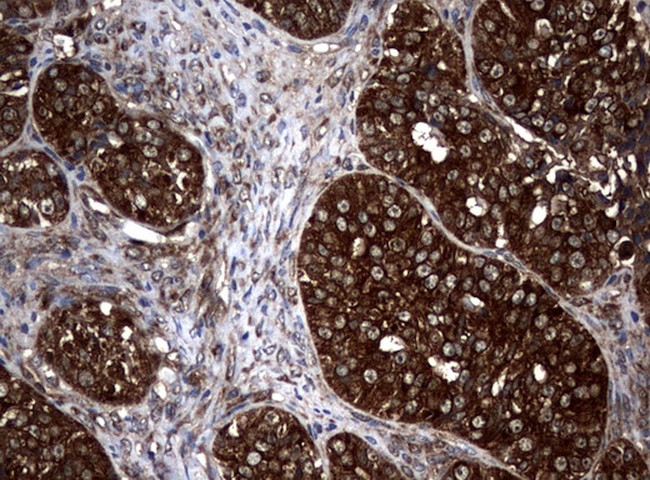 NME1 Antibody in Immunohistochemistry (Paraffin) (IHC (P))