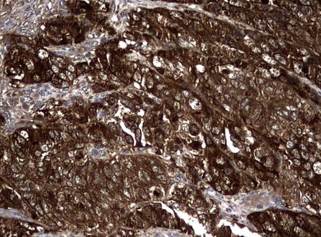 NME1 Antibody in Immunohistochemistry (Paraffin) (IHC (P))