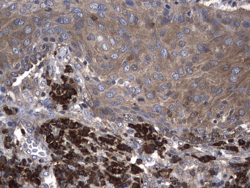 NME1 Antibody in Immunohistochemistry (Paraffin) (IHC (P))