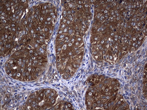 NME1 Antibody in Immunohistochemistry (Paraffin) (IHC (P))