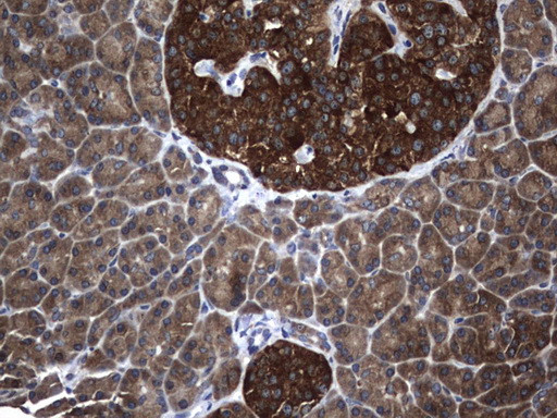 NME1 Antibody in Immunohistochemistry (Paraffin) (IHC (P))