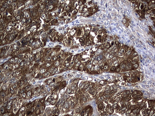 NME1 Antibody in Immunohistochemistry (Paraffin) (IHC (P))