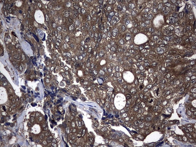 NME1 Antibody in Immunohistochemistry (Paraffin) (IHC (P))