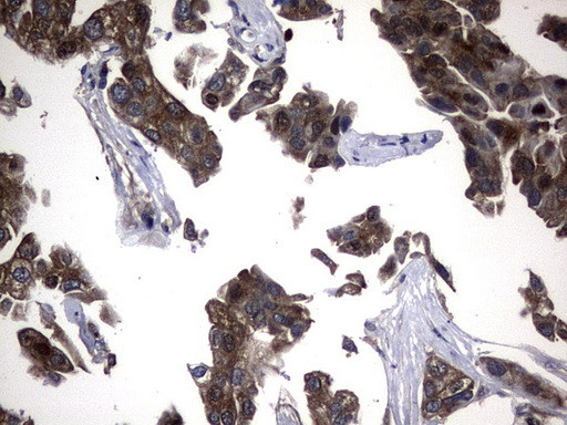 NME1 Antibody in Immunohistochemistry (Paraffin) (IHC (P))