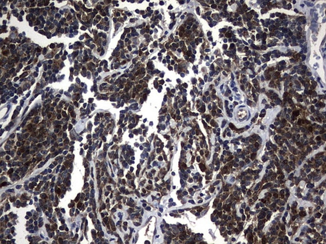 NME1 Antibody in Immunohistochemistry (Paraffin) (IHC (P))