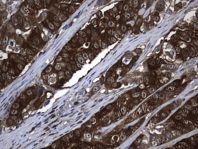 NME1 Antibody in Immunohistochemistry (Paraffin) (IHC (P))