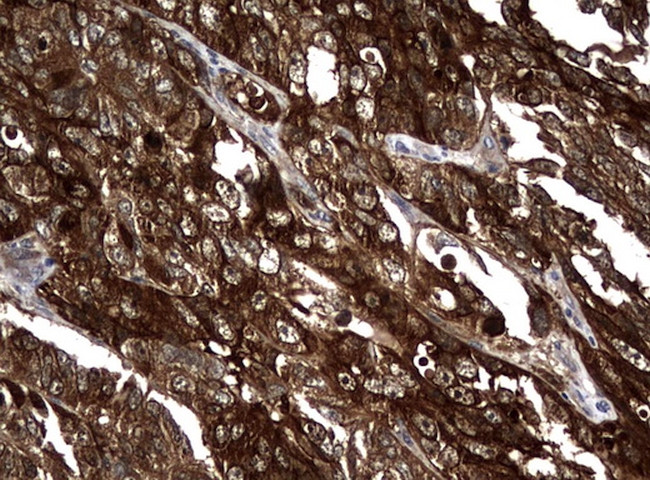 NME1 Antibody in Immunohistochemistry (Paraffin) (IHC (P))