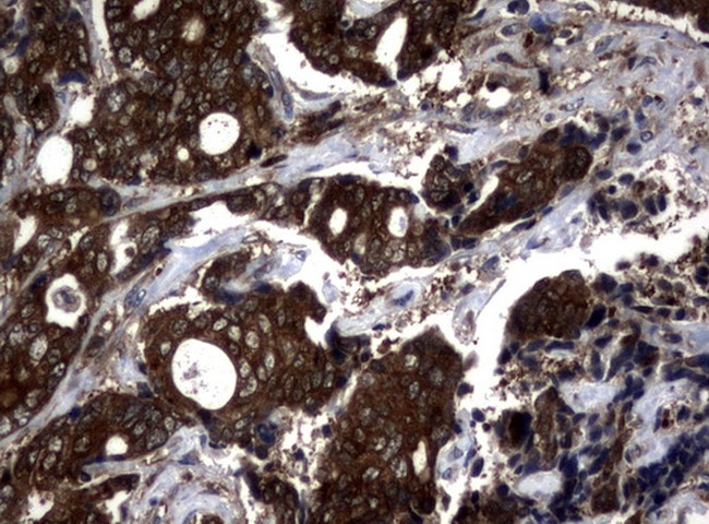 NME1 Antibody in Immunohistochemistry (Paraffin) (IHC (P))