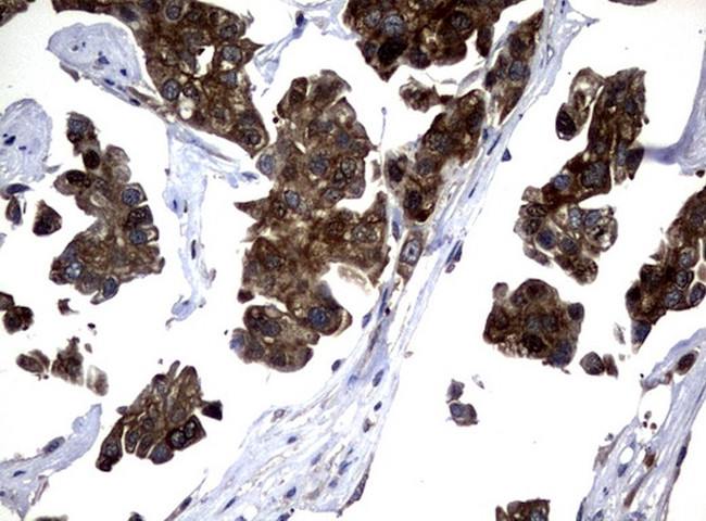 NME1 Antibody in Immunohistochemistry (Paraffin) (IHC (P))