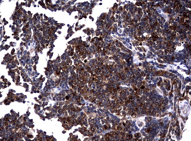 NME1 Antibody in Immunohistochemistry (Paraffin) (IHC (P))