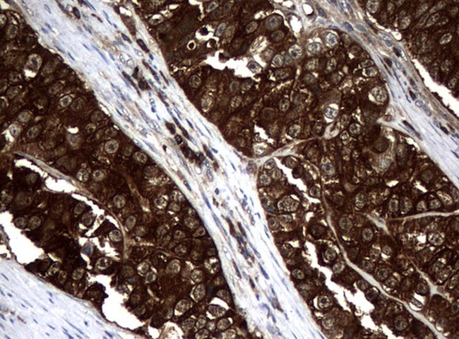 NME1 Antibody in Immunohistochemistry (Paraffin) (IHC (P))