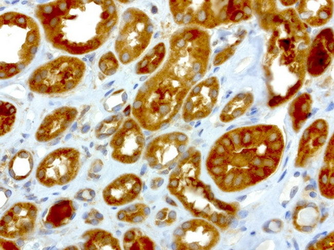 NME1 Antibody in Immunohistochemistry (Paraffin) (IHC (P))