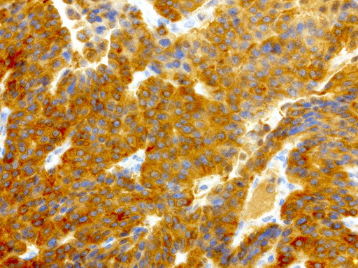 NME1 Antibody in Immunohistochemistry (Paraffin) (IHC (P))