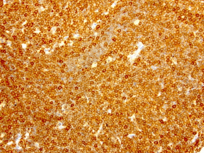 NME1 Antibody in Immunohistochemistry (Paraffin) (IHC (P))