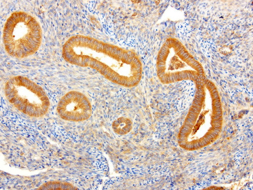 NME1 Antibody in Immunohistochemistry (Paraffin) (IHC (P))