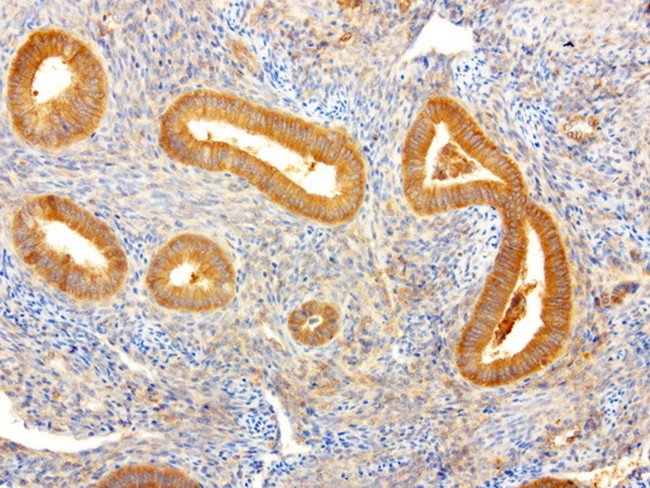 NME1 Antibody in Immunohistochemistry (Paraffin) (IHC (P))