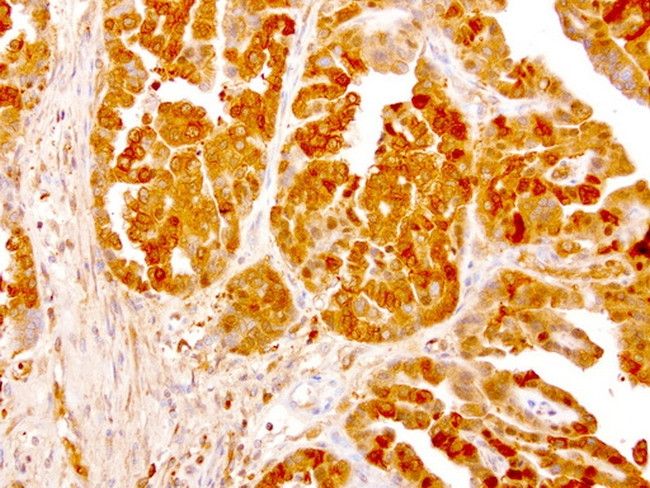 NME1 Antibody in Immunohistochemistry (Paraffin) (IHC (P))