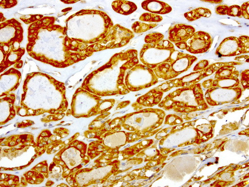 NME1 Antibody in Immunohistochemistry (Paraffin) (IHC (P))