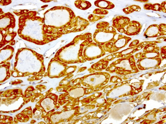 NME1 Antibody in Immunohistochemistry (Paraffin) (IHC (P))