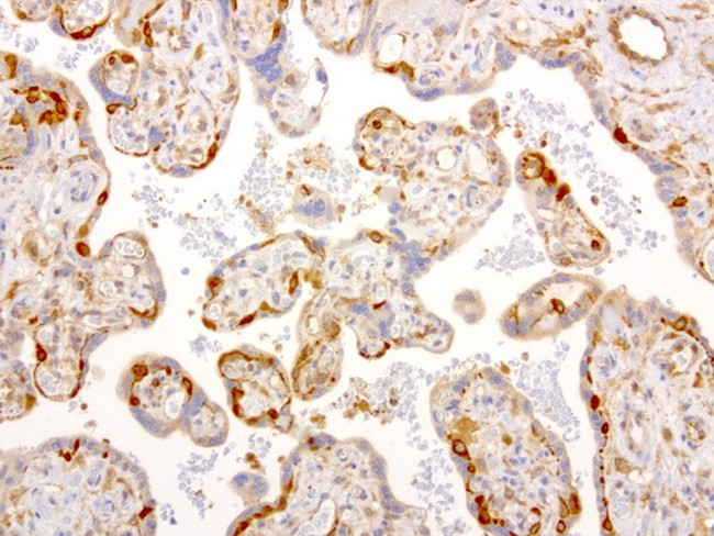 NME1 Antibody in Immunohistochemistry (Paraffin) (IHC (P))