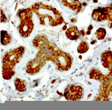 NME1 Antibody in Immunohistochemistry (Paraffin) (IHC (P))