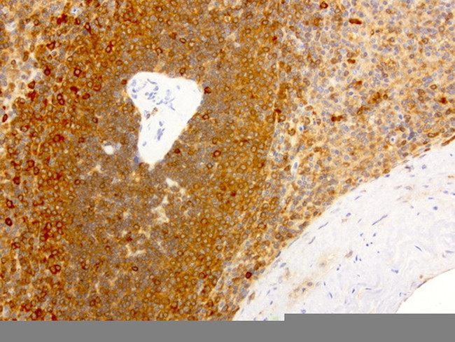 NME1 Antibody in Immunohistochemistry (Paraffin) (IHC (P))