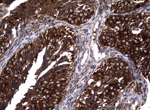 NME1 Antibody in Immunohistochemistry (Paraffin) (IHC (P))