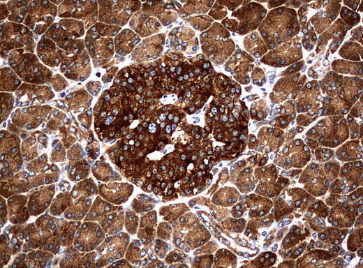 NME1 Antibody in Immunohistochemistry (Paraffin) (IHC (P))