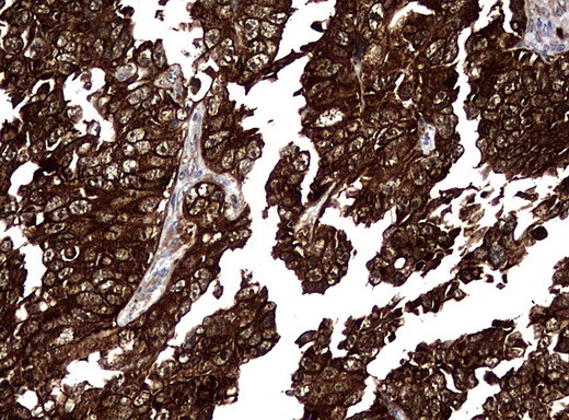 NME1 Antibody in Immunohistochemistry (Paraffin) (IHC (P))