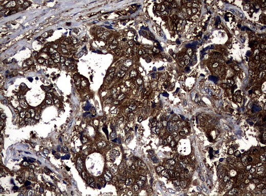 NME1 Antibody in Immunohistochemistry (Paraffin) (IHC (P))