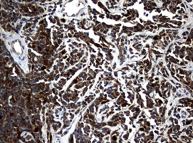 NME1 Antibody in Immunohistochemistry (Paraffin) (IHC (P))