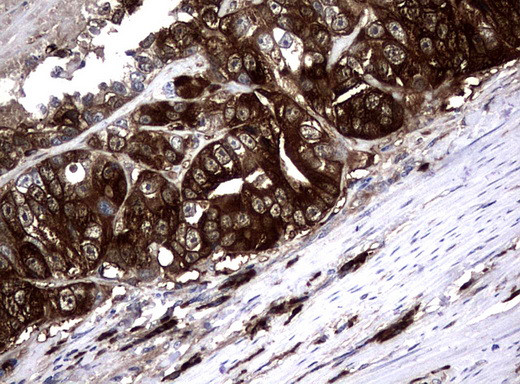 NME1 Antibody in Immunohistochemistry (Paraffin) (IHC (P))