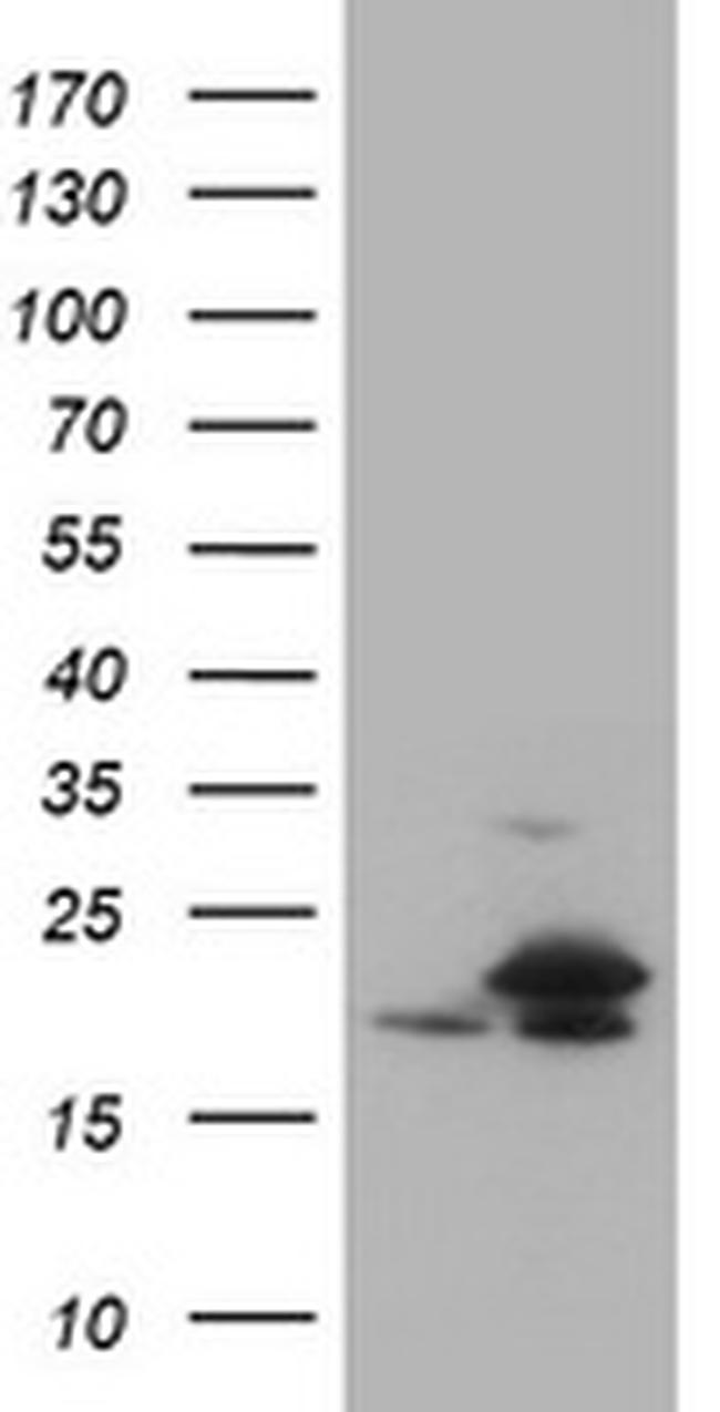 NME1 Antibody in Western Blot (WB)