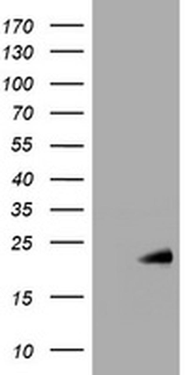 NME1 Antibody in Western Blot (WB)