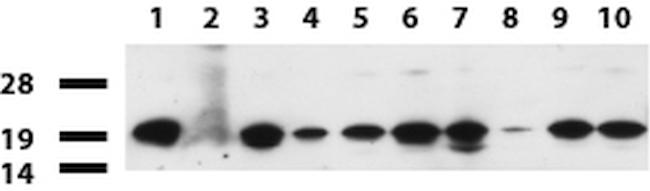 NME1 Antibody in Western Blot (WB)