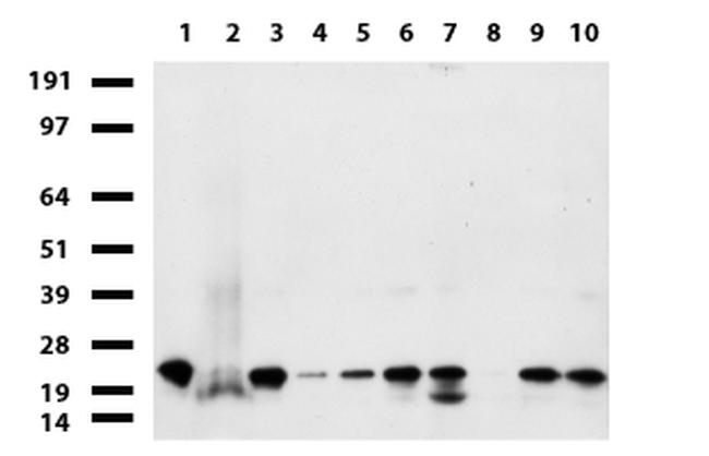 NME1 Antibody in Western Blot (WB)