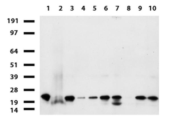 NME1 Antibody in Western Blot (WB)