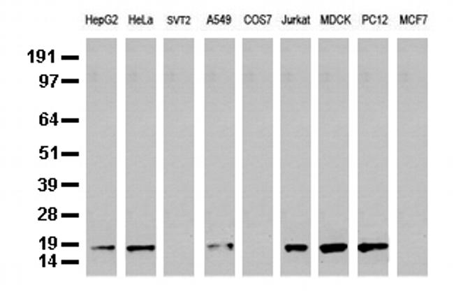 NME1 Antibody in Western Blot (WB)