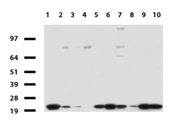 NME1 Antibody in Western Blot (WB)