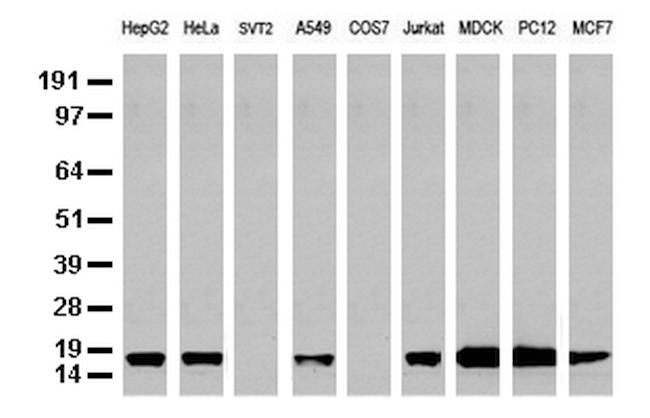 NME1 Antibody in Western Blot (WB)