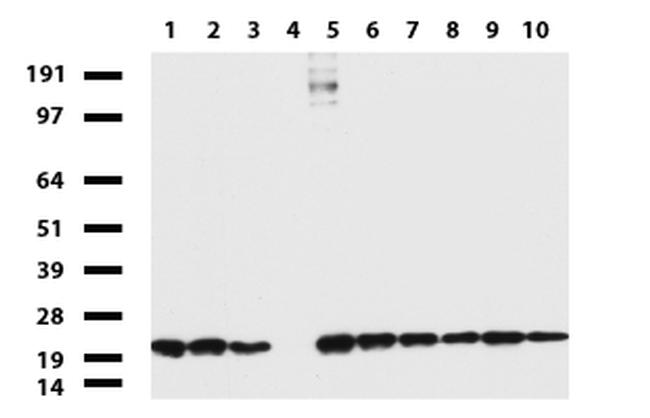 NME1 Antibody in Western Blot (WB)