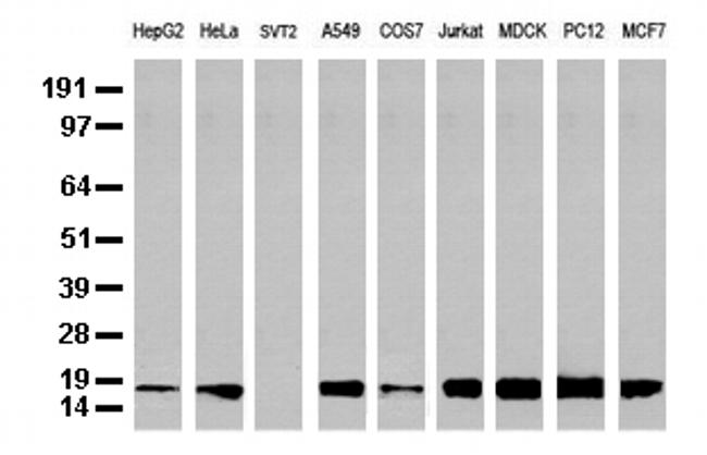 NME1 Antibody in Western Blot (WB)