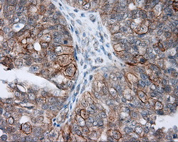 NME4 Antibody in Immunohistochemistry (Paraffin) (IHC (P))