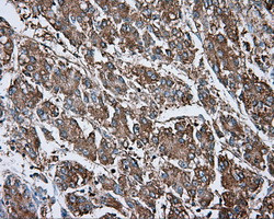 NME4 Antibody in Immunohistochemistry (Paraffin) (IHC (P))